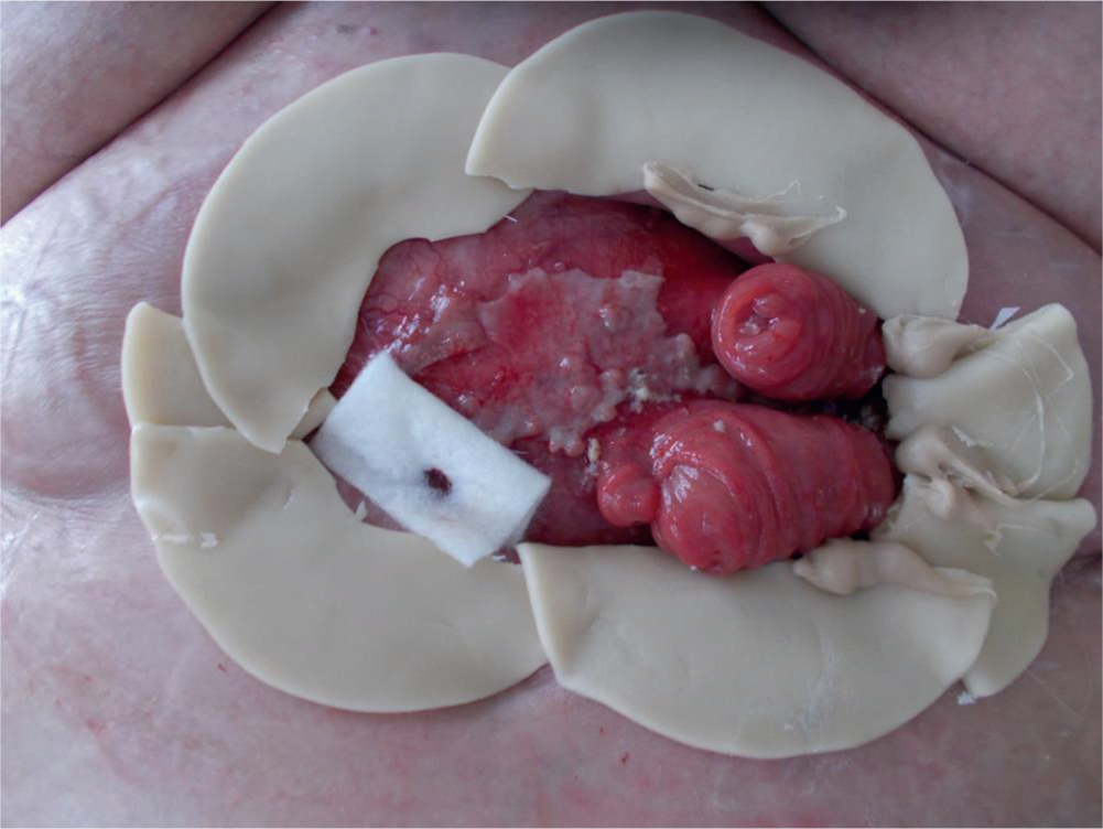 Wound Care Procedure Pack